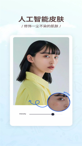 \